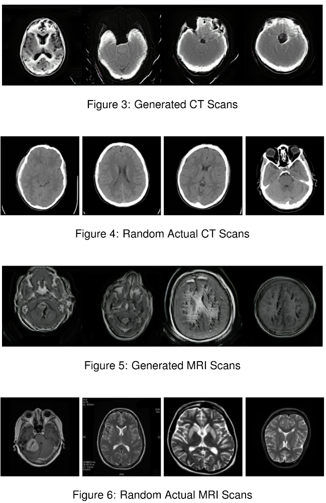 CycleGAN CT to MRI example